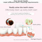LifeBasis Electric Tooth Polisher